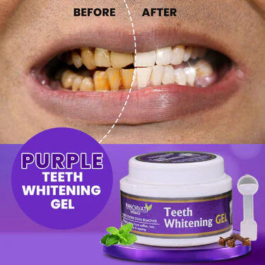 Purple Teeth Whitening Gel At Just 499/-